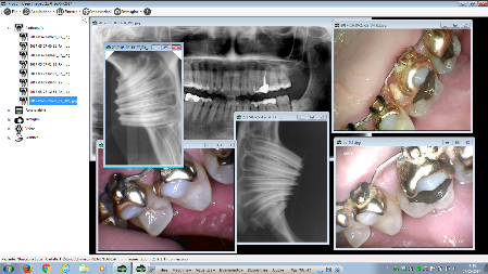 Programma di gestione immagini dentale 